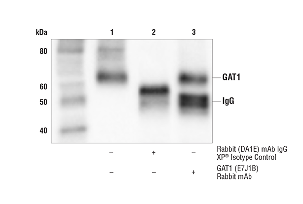  Image 16: Astrocyte Markers Antibody Sampler Kit