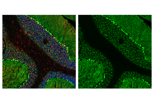  Image 22: Astrocyte Markers Antibody Sampler Kit