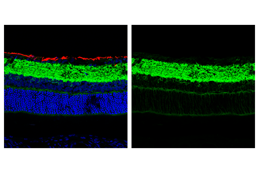  Image 27: Astrocyte Markers Antibody Sampler Kit