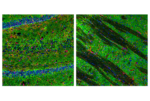  Image 33: Astrocyte Markers Antibody Sampler Kit