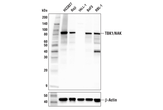  Image 13: Myddosome Complex Antibody Sampler Kit