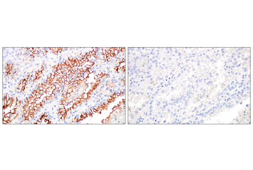 Immunohistochemistry Image 6: ACE2 (E9G3S) Mouse mAb