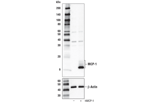  Image 7: Senescence Associated Secretory Phenotype (SASP) Antibody Sampler Kit