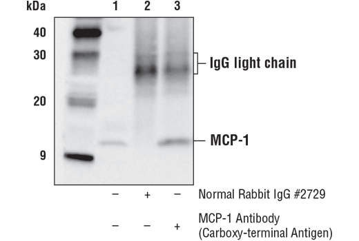  Image 18: Senescence Associated Secretory Phenotype (SASP) Antibody Sampler Kit