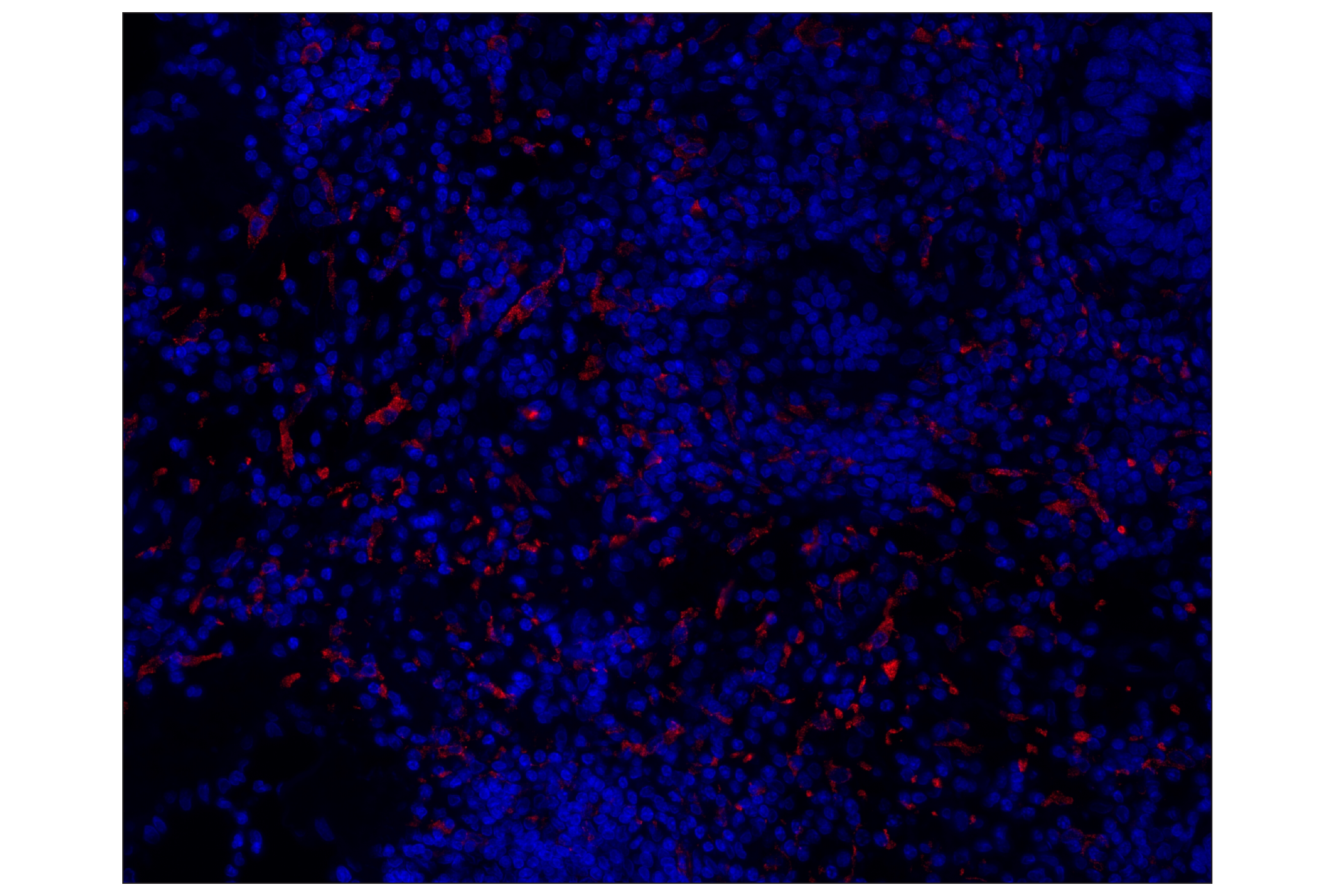 Immunohistochemistry Image 1: CD163 (D6U1J) Rabbit mAb (Alexa Fluor® 647 Conjugate)