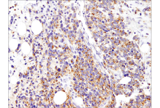 Immunohistochemistry Image 1: Mcl-1 (D5V5L) Rabbit mAb