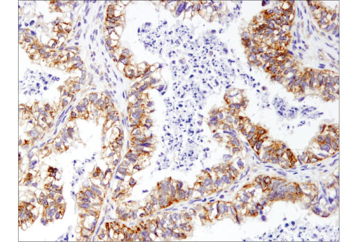 Immunohistochemistry Image 2: Mcl-1 (D5V5L) Rabbit mAb