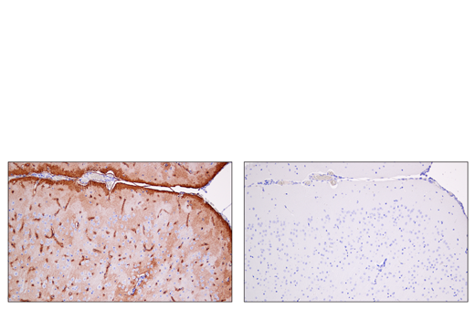 Immunohistochemistry Image 3: AQP4 (D1F8E) XP® Rabbit mAb (BSA and Azide Free)