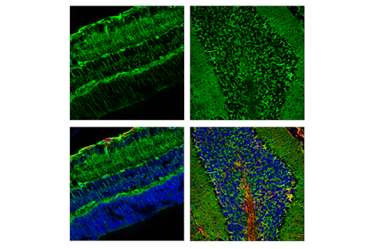 Immunofluorescence Image 1: AQP4 (D1F8E) XP® Rabbit mAb (BSA and Azide Free)