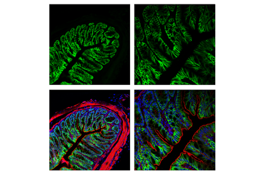 Immunofluorescence Image 3: AQP4 (D1F8E) XP® Rabbit mAb (BSA and Azide Free)