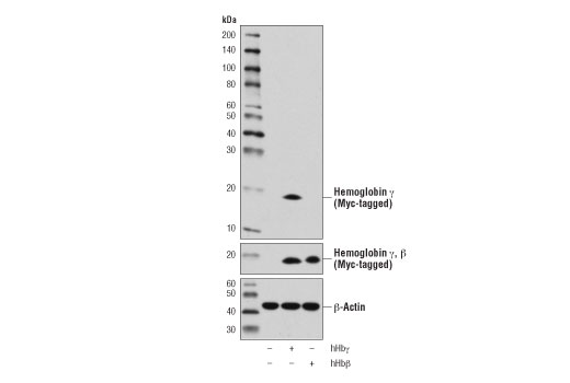 Western Blotting Image 2: Hemoglobin γ (D4K7X) Rabbit mAb