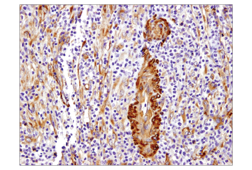 Immunohistochemistry Image 4: Vinculin (E1E9V) XP® Rabbit mAb (BSA and Azide Free)