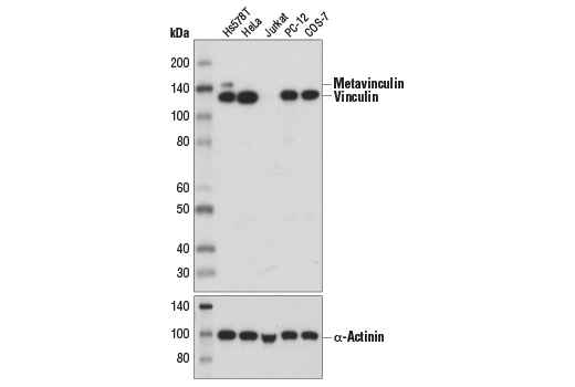 Western Blotting Image 1: Vinculin (E1E9V) XP® Rabbit mAb (BSA and Azide Free)