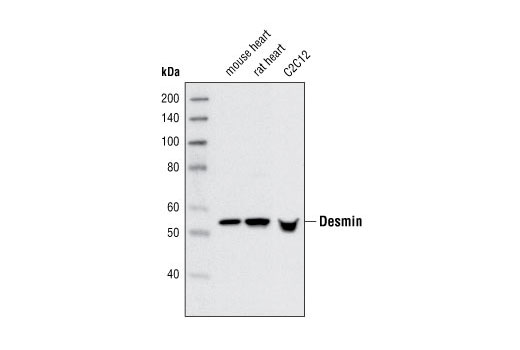 Western Blotting Image 1: Desmin Antibody