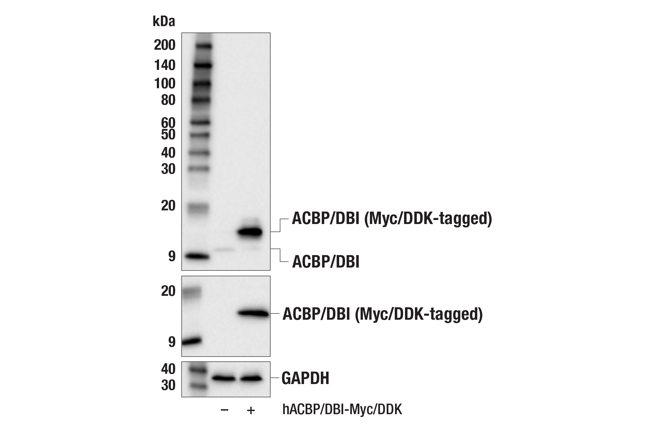 Western Blotting Image 2: ACBP/DBI (E4V8V) XP® Rabbit mAb