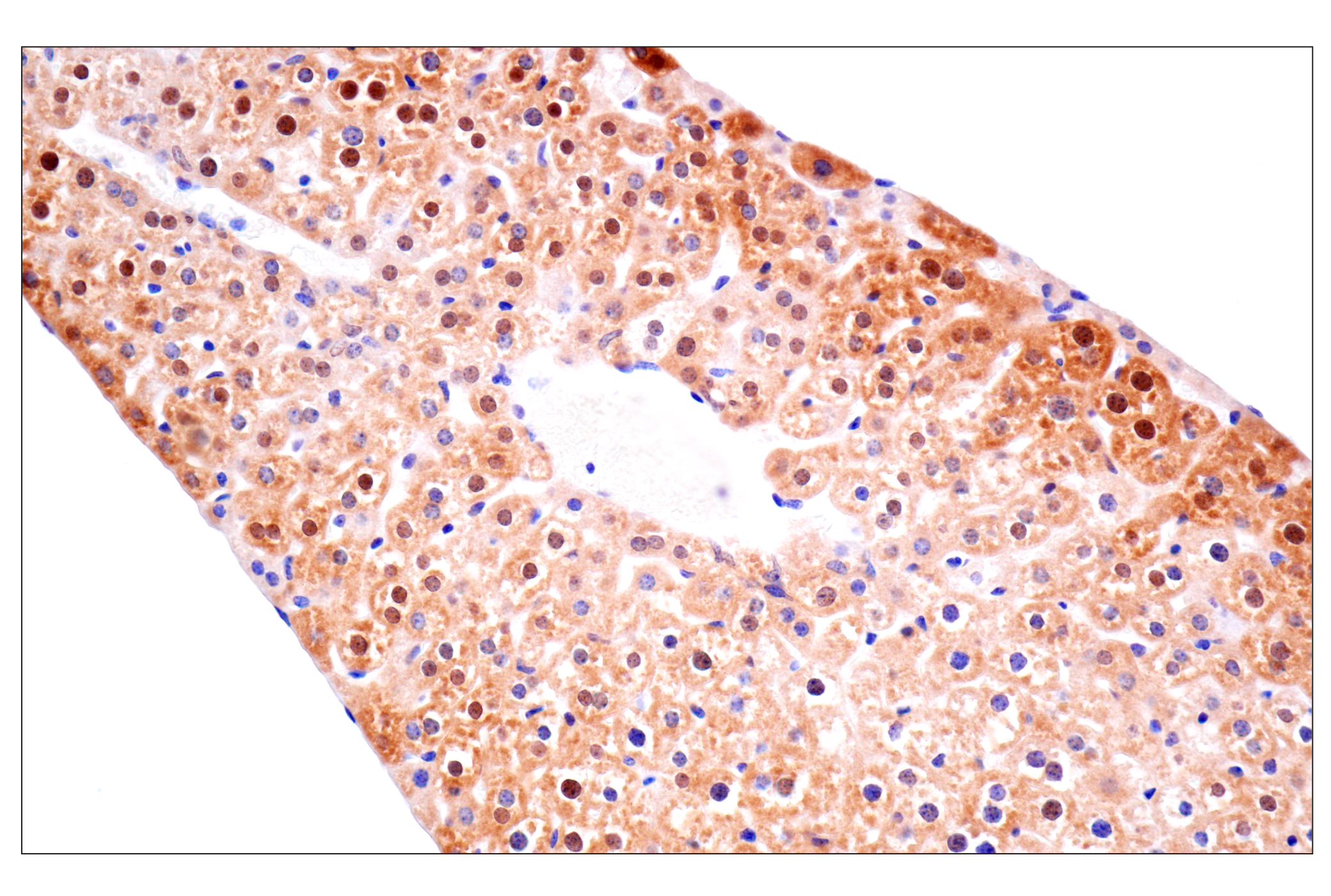 Immunohistochemistry Image 12: ACBP/DBI (E4V8V) XP® Rabbit mAb