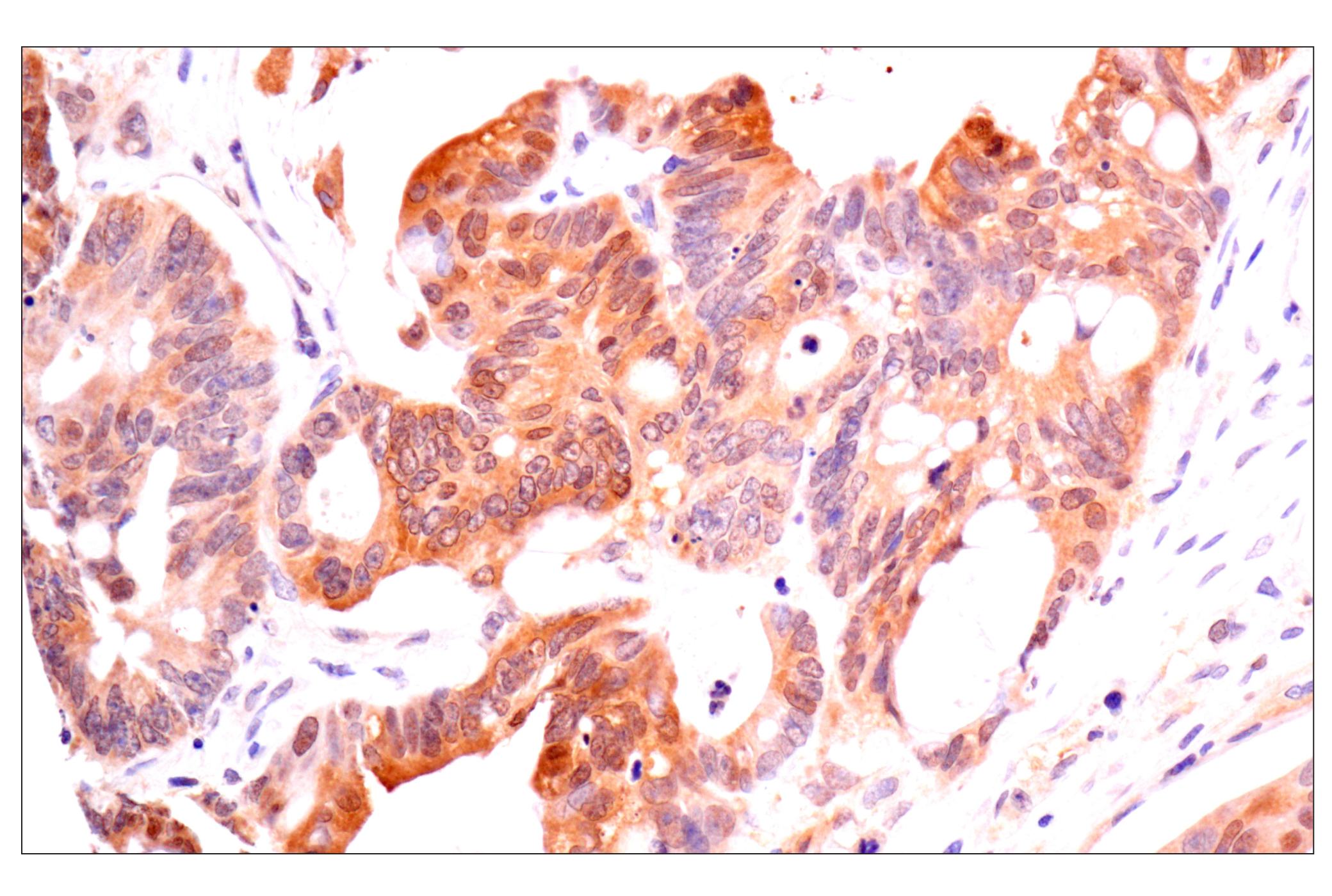 Immunohistochemistry Image 3: ACBP/DBI (E4V8V) XP® Rabbit mAb