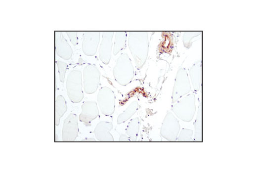  Image 47: Hypoxia Activation IHC Antibody Sampler Kit