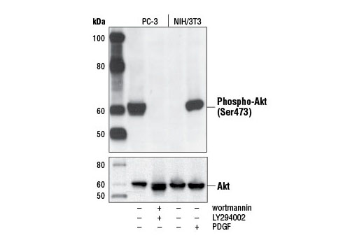 Image 6: Phospho-Akt Pathway Antibody Sampler Kit