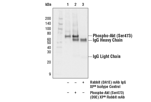  Image 14: Phospho-Akt Pathway Antibody Sampler Kit