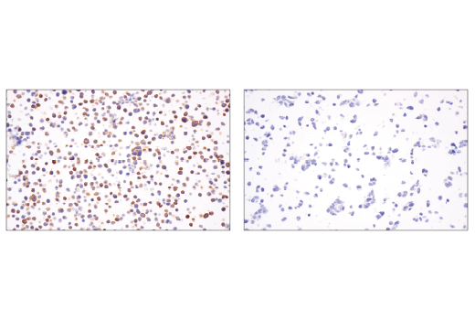 Immunohistochemistry Image 2: CD6 (E9Y7Y) Rabbit mAb