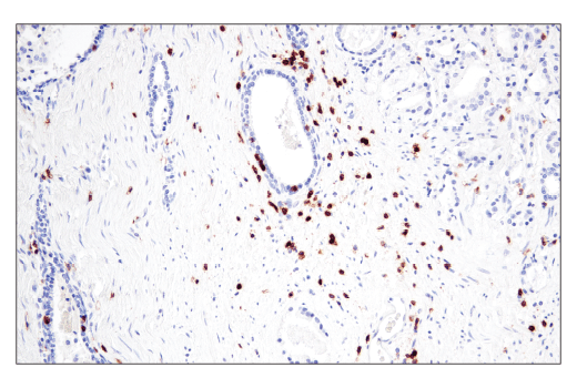 Immunohistochemistry Image 6: CD6 (E9Y7Y) Rabbit mAb