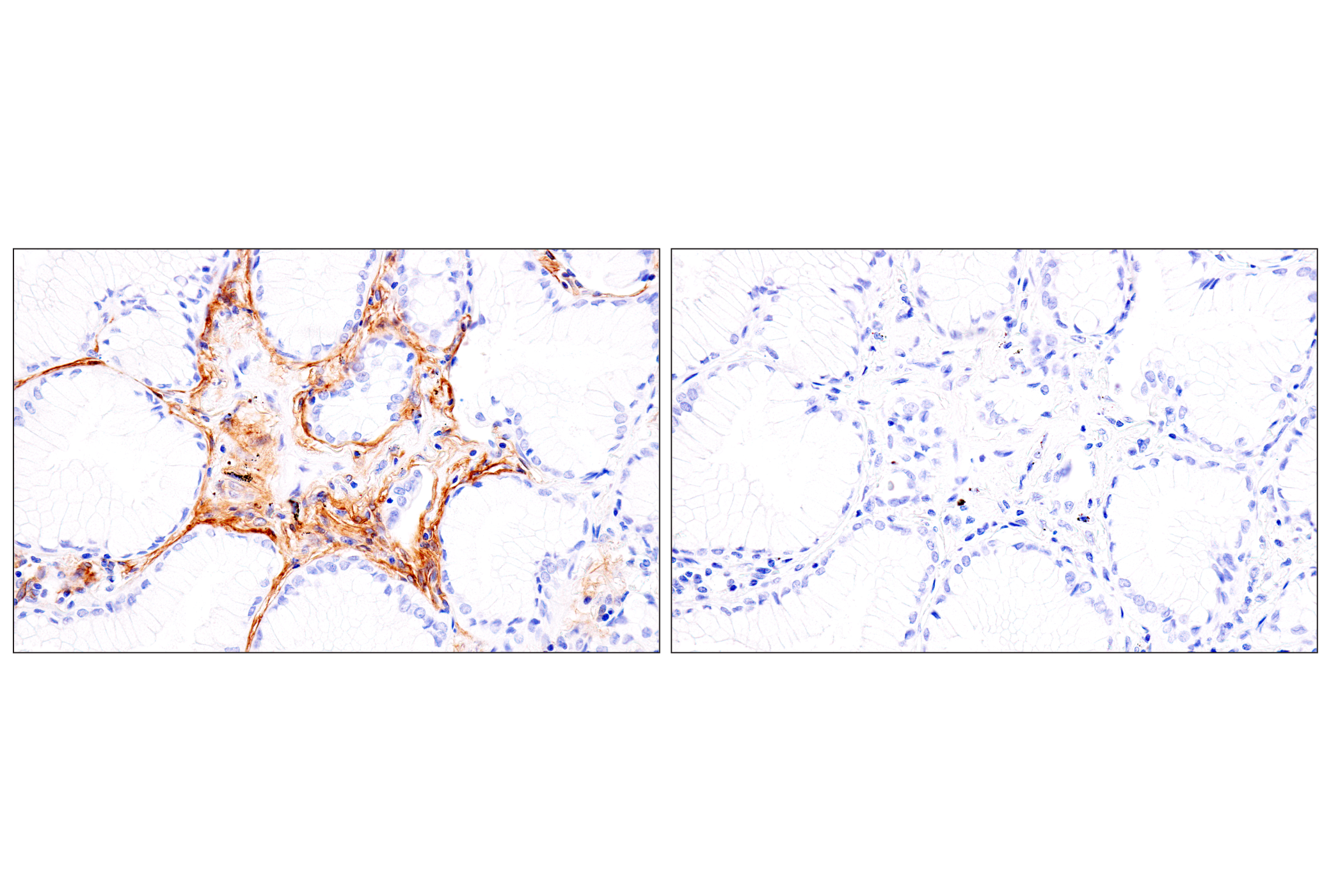 Immunohistochemistry Image 20: p75NTR (E7I3M) Rabbit mAb