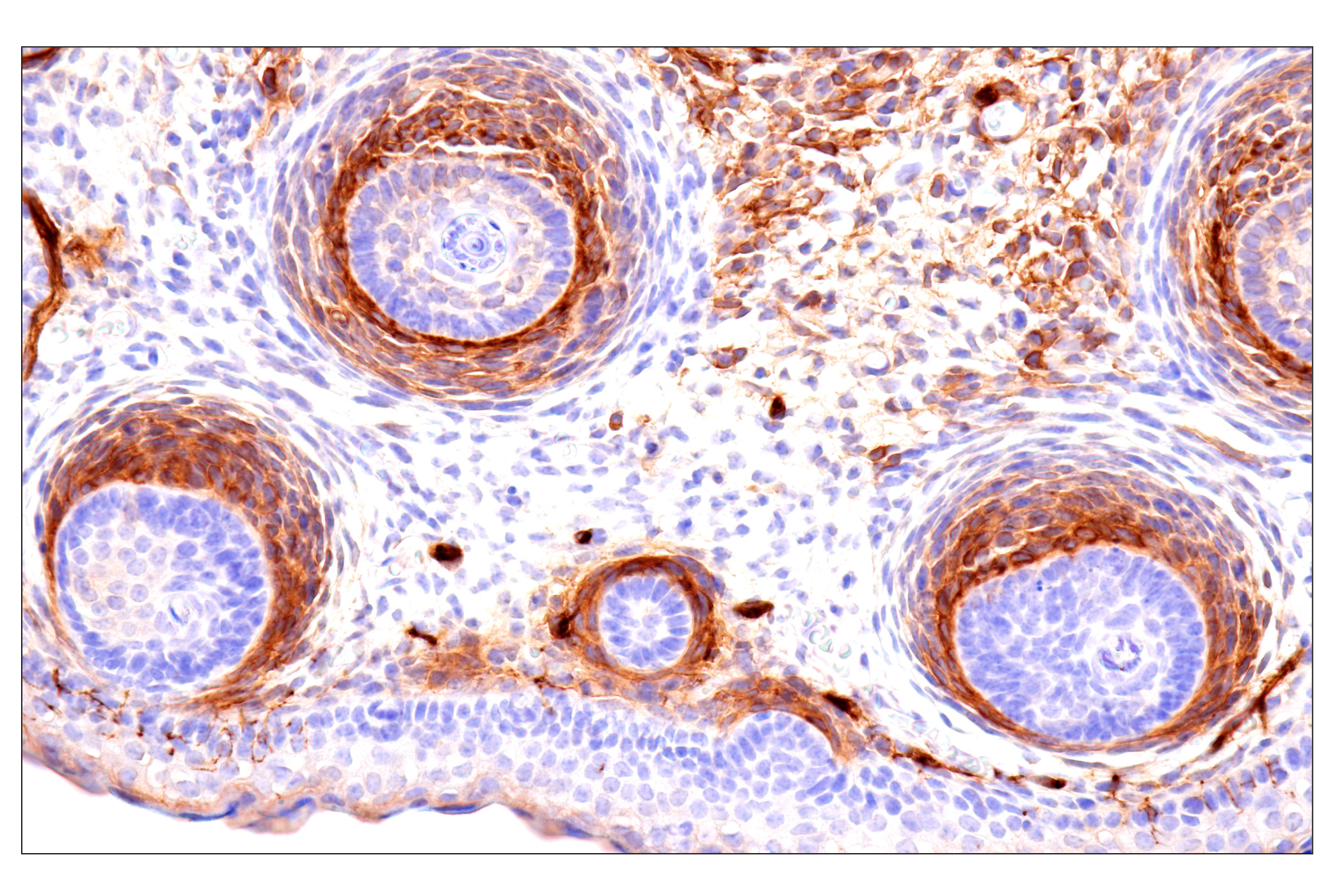 Immunohistochemistry Image 19: p75NTR (E7I3M) Rabbit mAb