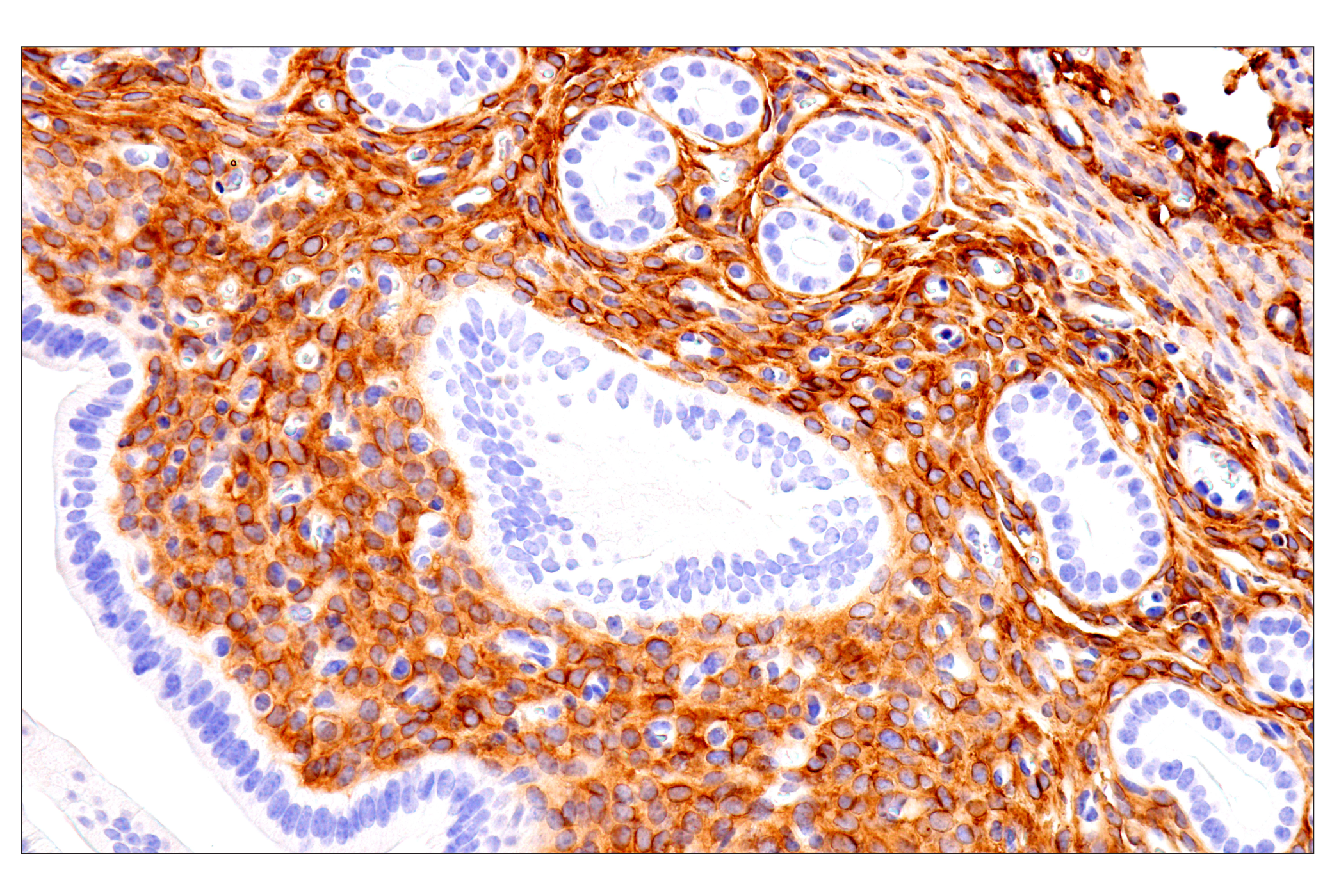 Immunohistochemistry Image 18: p75NTR (E7I3M) Rabbit mAb