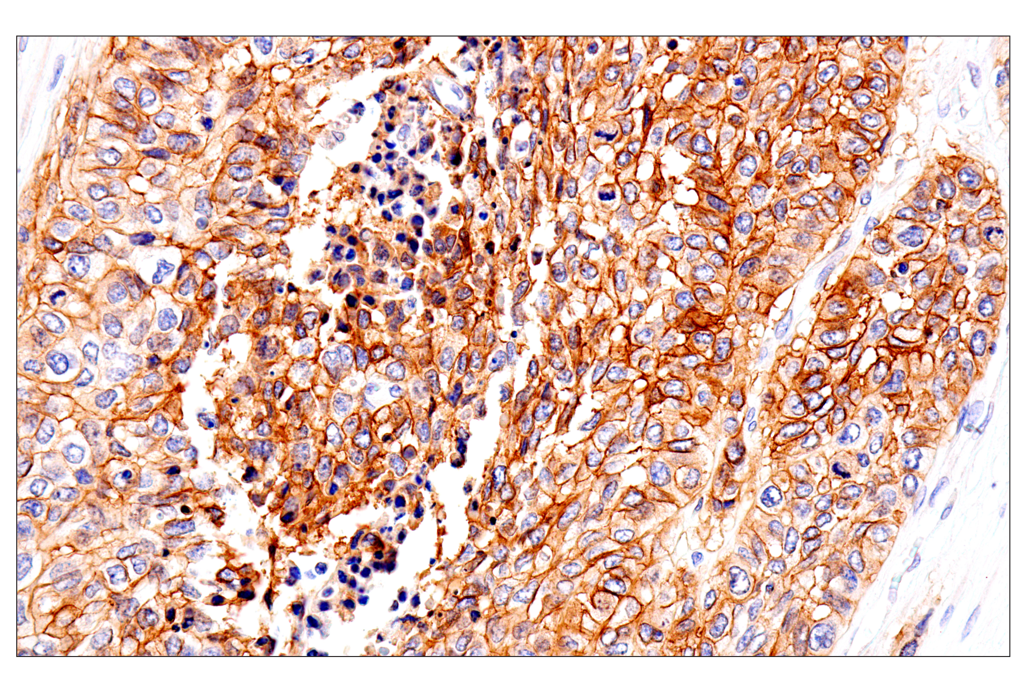 Immunohistochemistry Image 1: p75NTR (E7I3M) Rabbit mAb