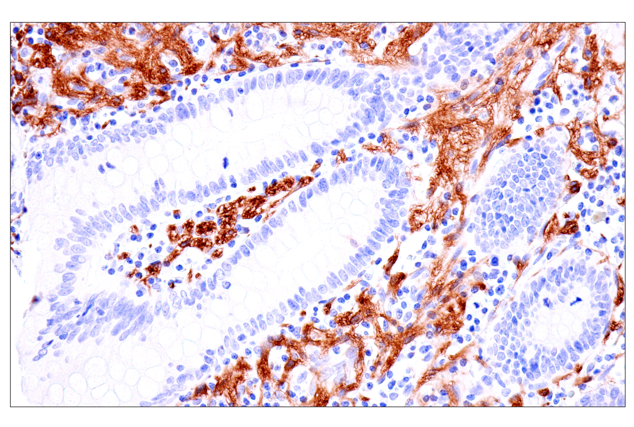 Immunohistochemistry Image 13: p75NTR (E7I3M) Rabbit mAb