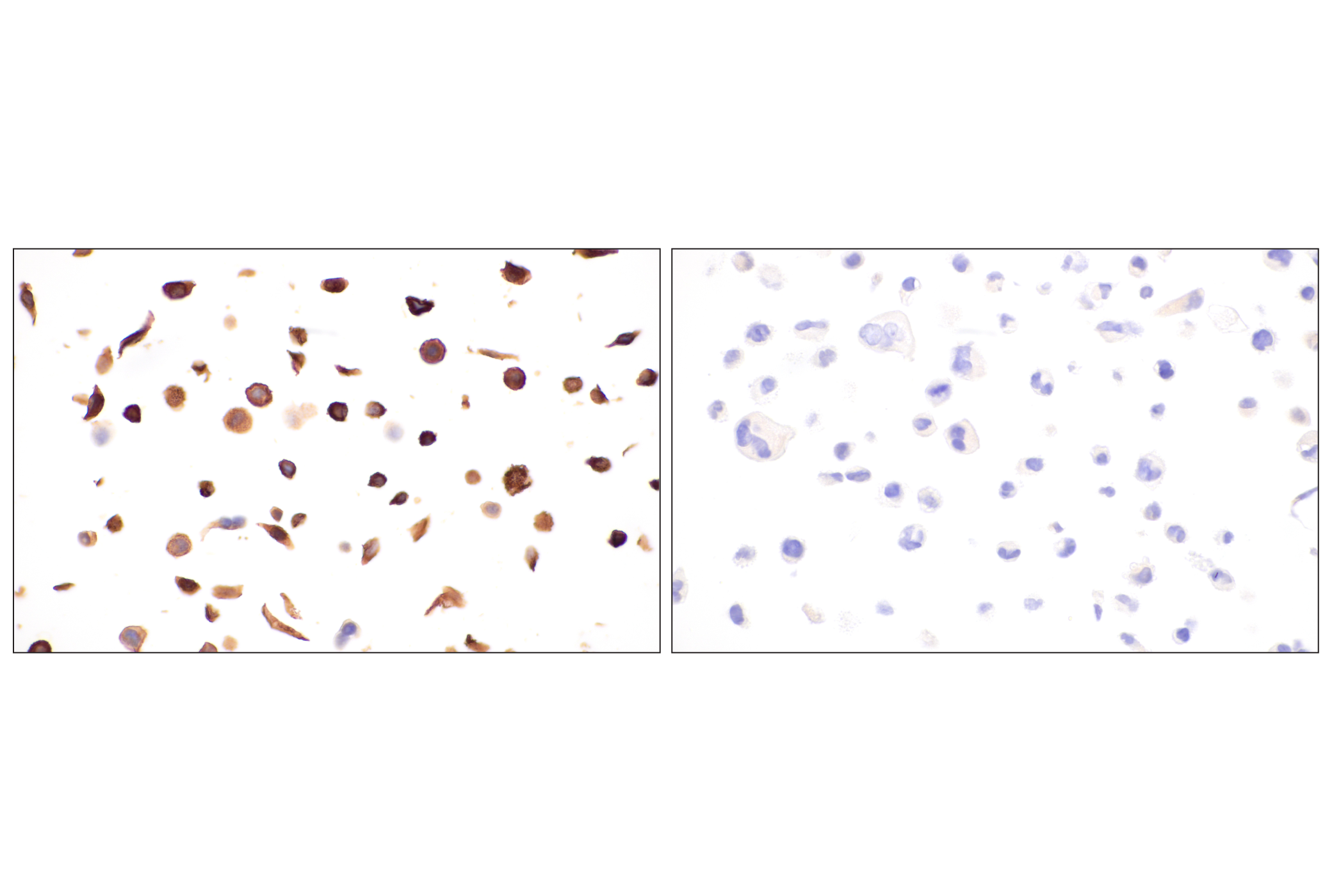 Immunohistochemistry Image 21: p75NTR (E7I3M) Rabbit mAb