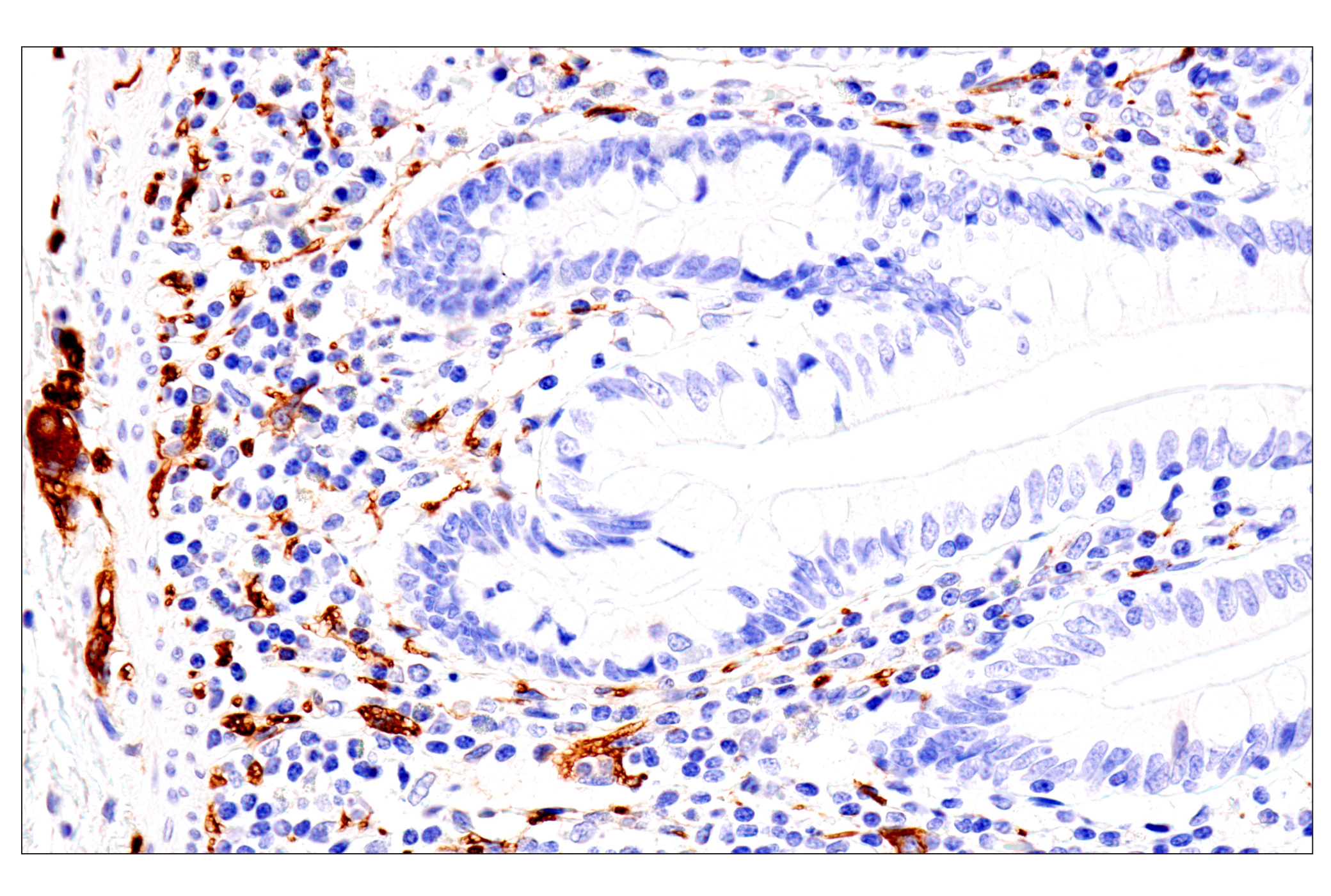 Immunohistochemistry Image 8: p75NTR (E7I3M) Rabbit mAb