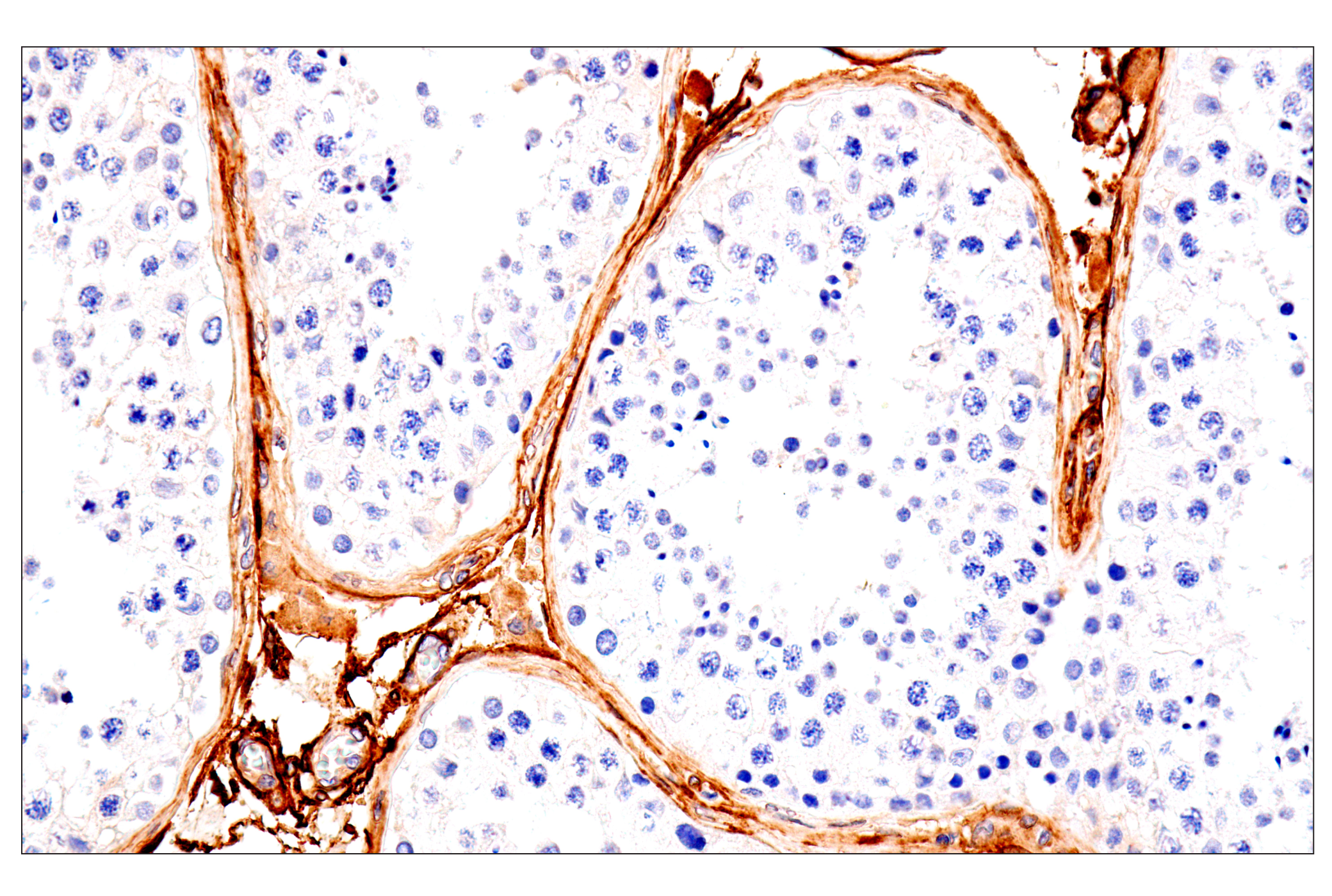 Immunohistochemistry Image 7: p75NTR (E7I3M) Rabbit mAb