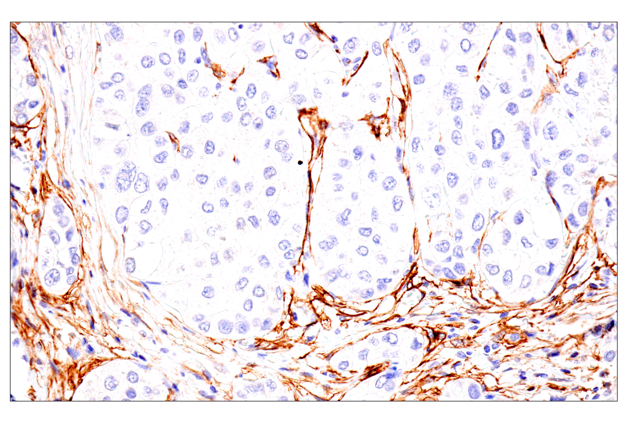 Immunohistochemistry Image 3: p75NTR (E7I3M) Rabbit mAb