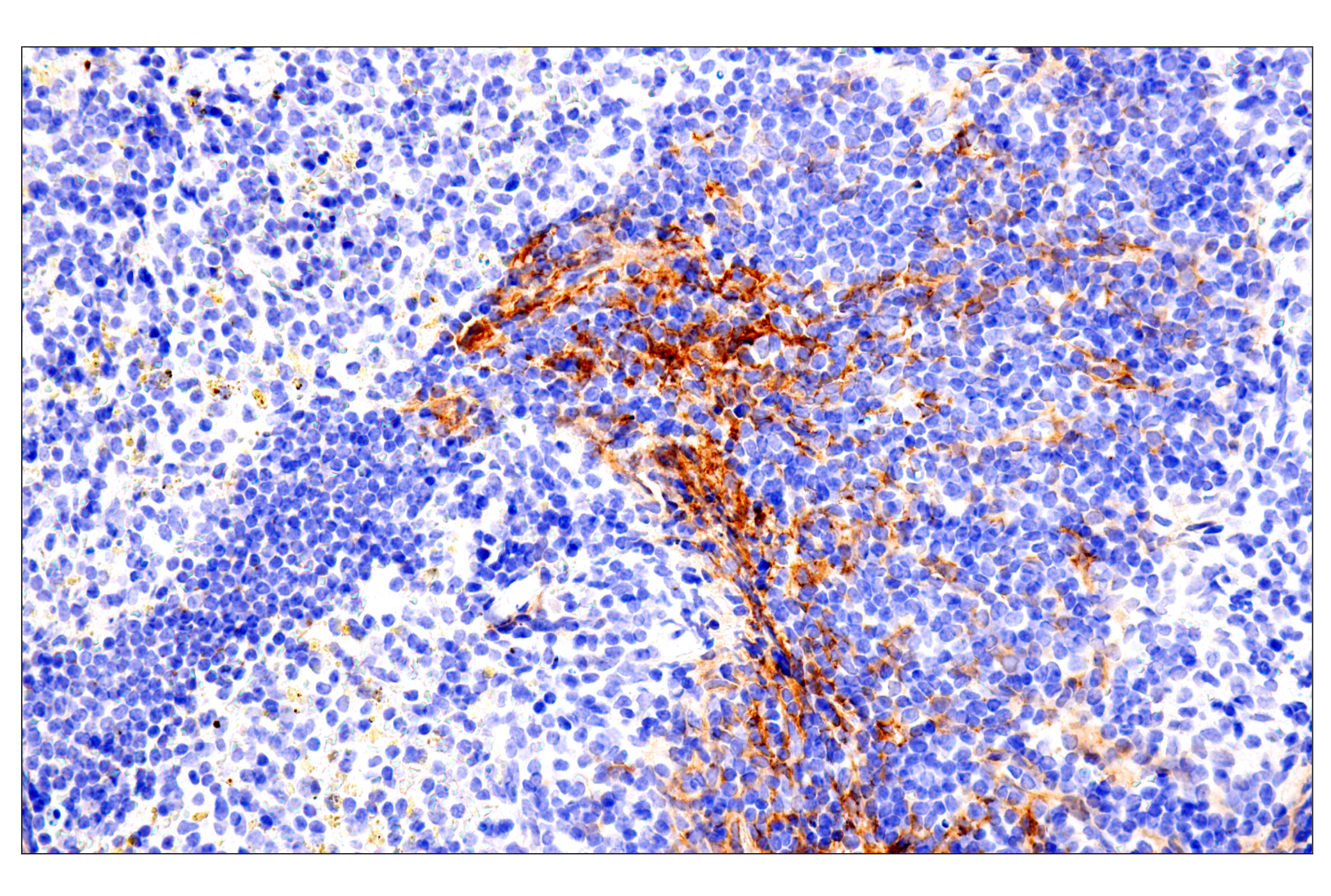 Immunohistochemistry Image 16: p75NTR (E7I3M) Rabbit mAb