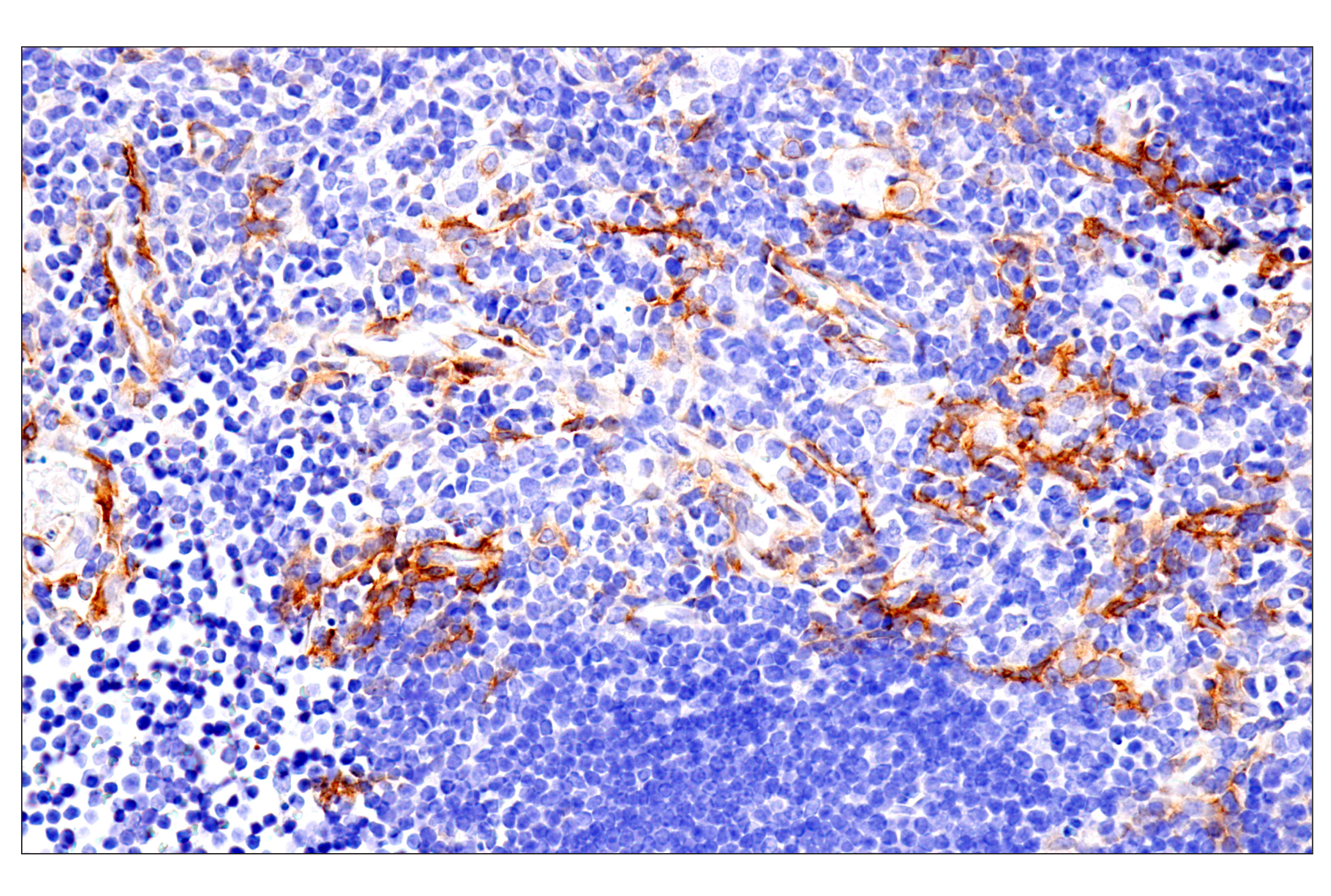 Immunohistochemistry Image 17: p75NTR (E7I3M) Rabbit mAb