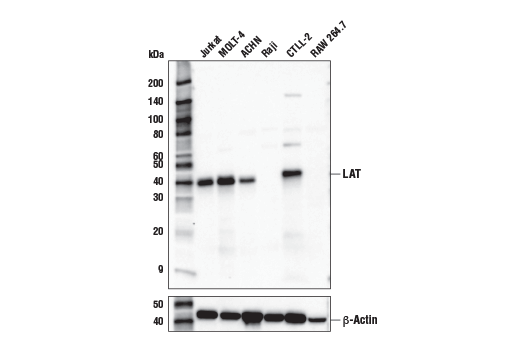 Western Blotting Image 1: LAT (E3U6J) XP® Rabbit mAb (BSA and Azide Free)