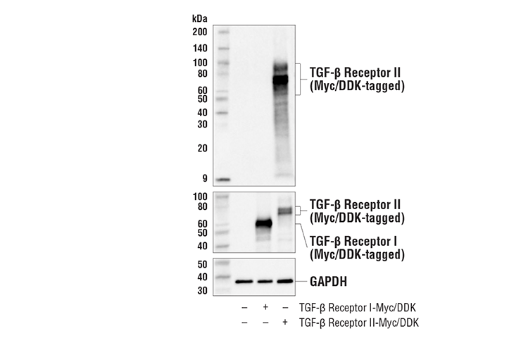  Image 6: TGF-β Fibrosis Pathway Antibody Sampler Kit