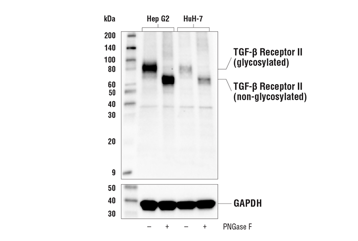 Image 17: TGF-β Fibrosis Pathway Antibody Sampler Kit