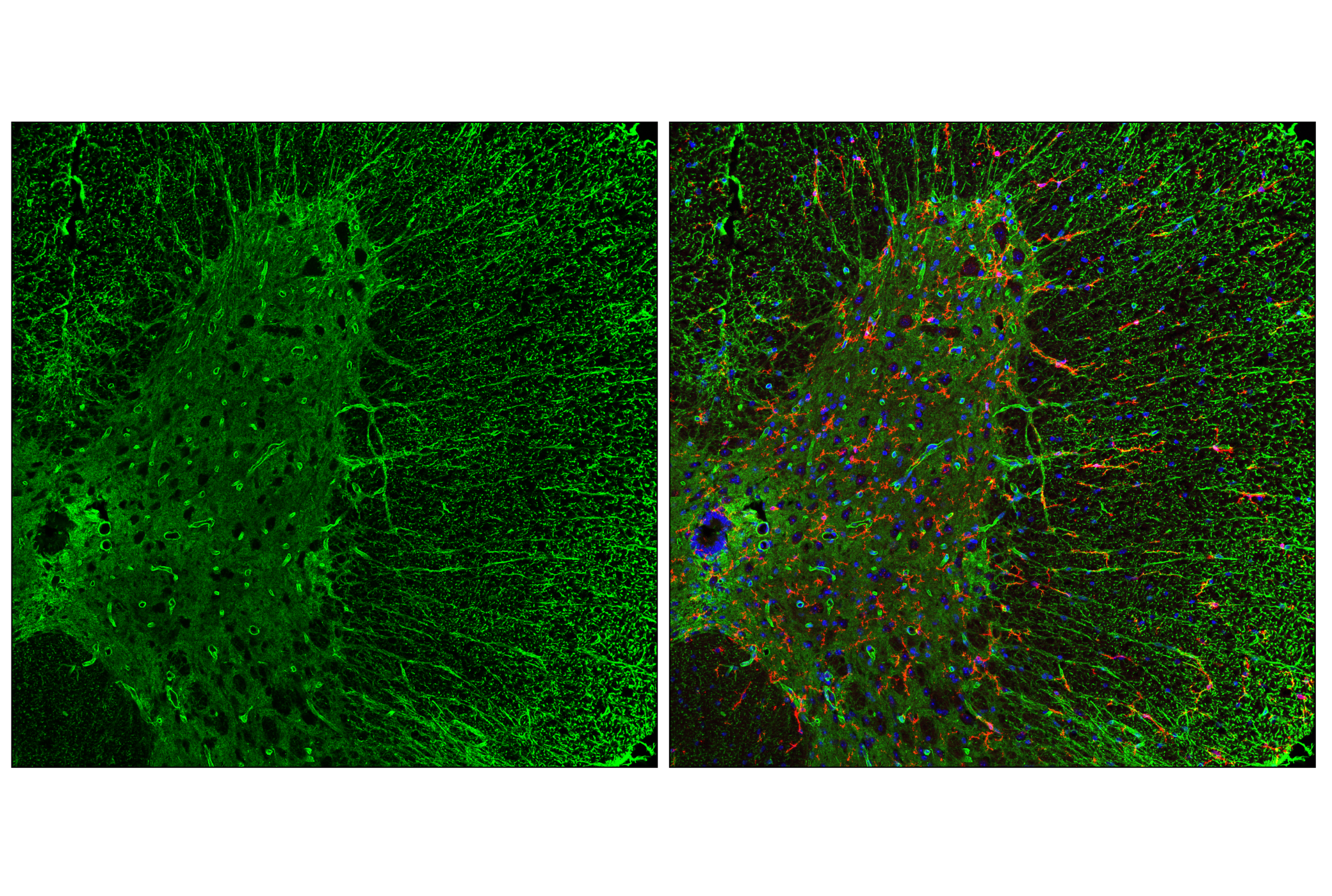 Immunofluorescence Image 2: AQP4 (E8W5A) Mouse mAb