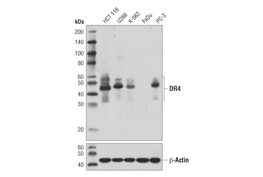 Western Blotting Image 1: DR4 (D9S1R) Rabbit mAb