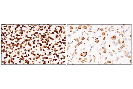 Immunohistochemistry Image 12: CD38 (E7Z8C) XP® Rabbit mAb (BSA and Azide Free)