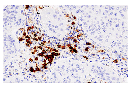 Immunohistochemistry Image 1: CD38 (E7Z8C) XP® Rabbit mAb (BSA and Azide Free)