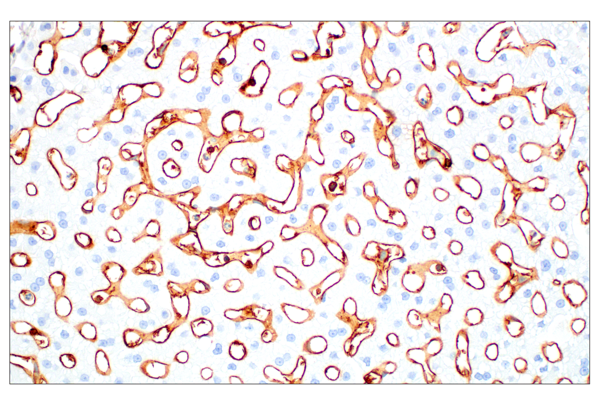 Immunohistochemistry Image 9: CD38 (E7Z8C) XP® Rabbit mAb (BSA and Azide Free)