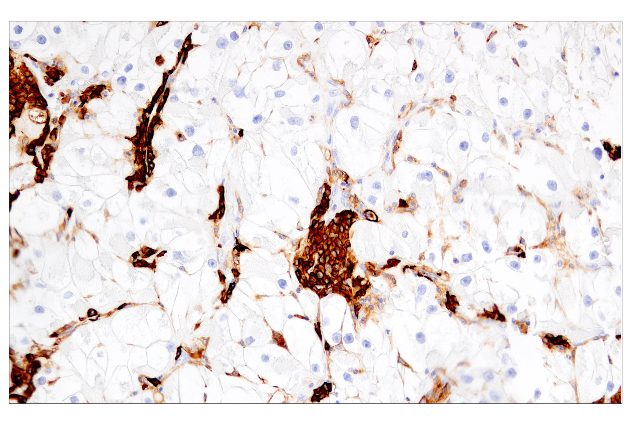 Immunohistochemistry Image 6: CD38 (E7Z8C) XP® Rabbit mAb (BSA and Azide Free)