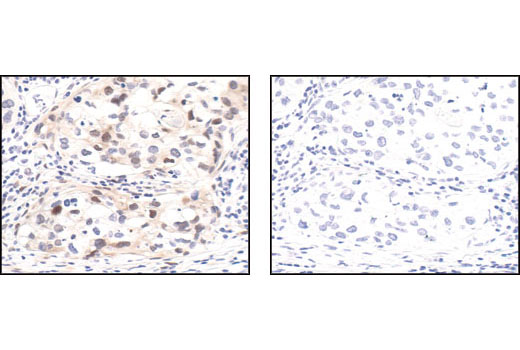 Immunohistochemistry Image 3: Phospho-p44/42 MAPK (Erk1/2) (Thr202/Tyr204) (20G11) Rabbit mAb