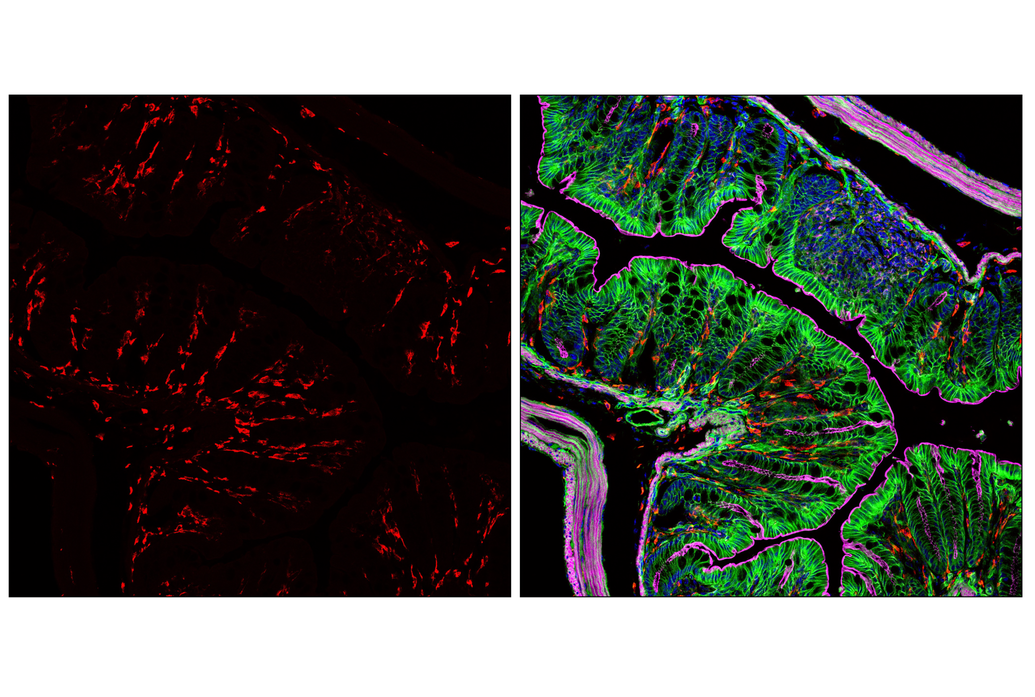 Immunofluorescence Image 1: CD206/MRC1 (E6T5J) XP® Rabbit mAb (Alexa Fluor® 647 Conjugate)