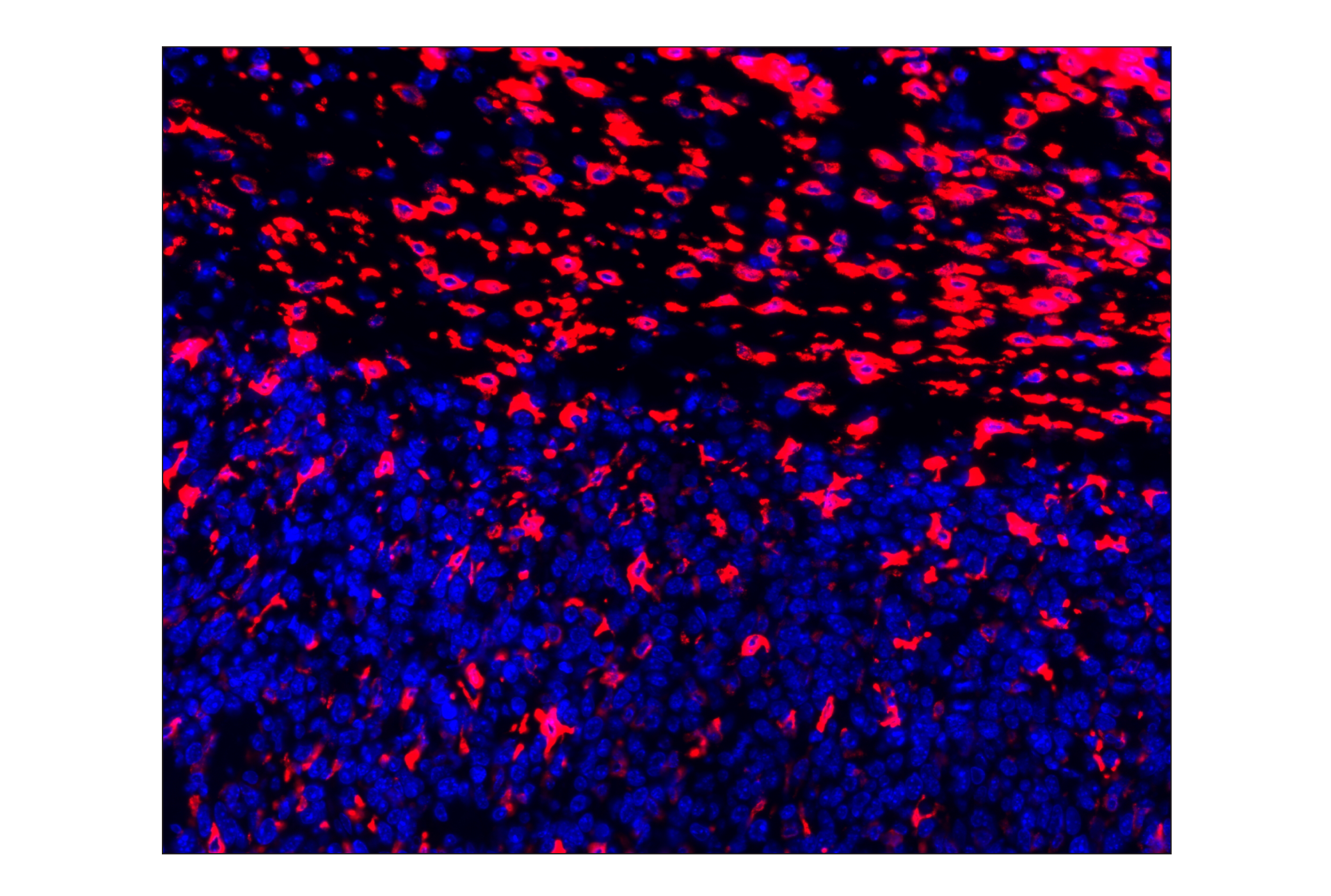 Immunohistochemistry Image 1: CD206/MRC1 (E6T5J) XP® Rabbit mAb (Alexa Fluor® 647 Conjugate)