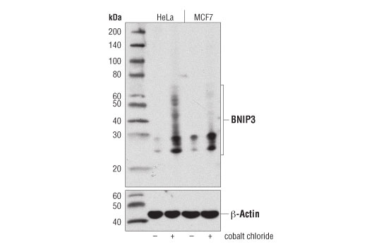  Image 5: Mitophagy Antibody Sampler Kit